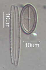 Diatom